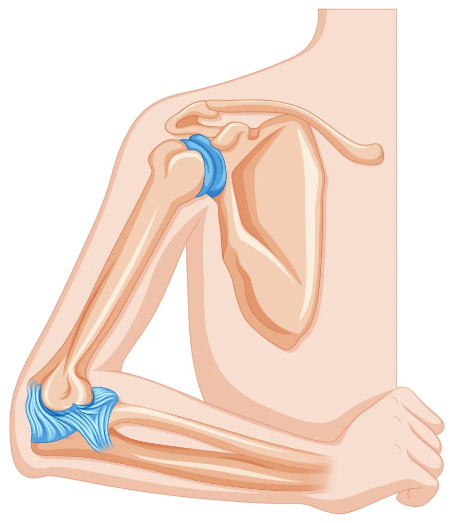 sports injury specialist UAE